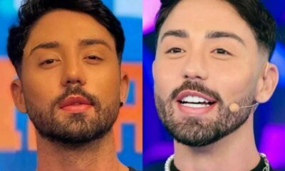 Rico Melquiades expoe incomodo e diz que realizara cirurgia para