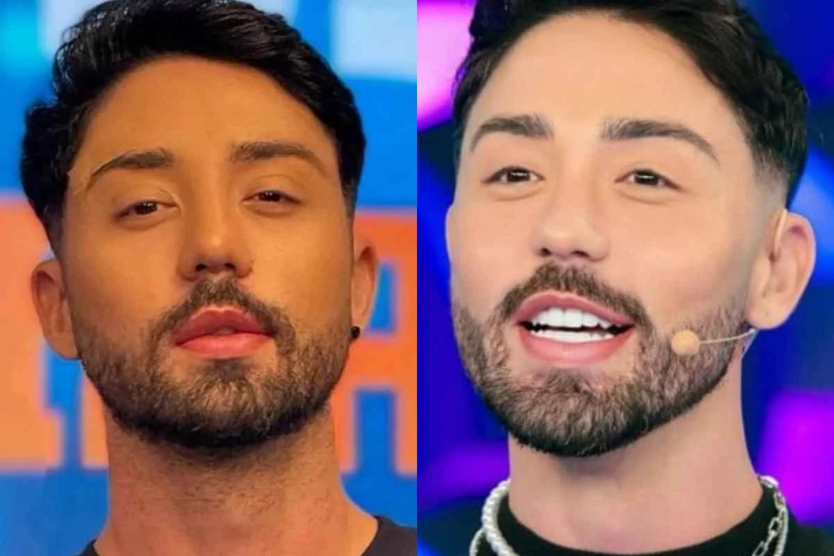 Rico Melquiades expoe incomodo e diz que realizara cirurgia para