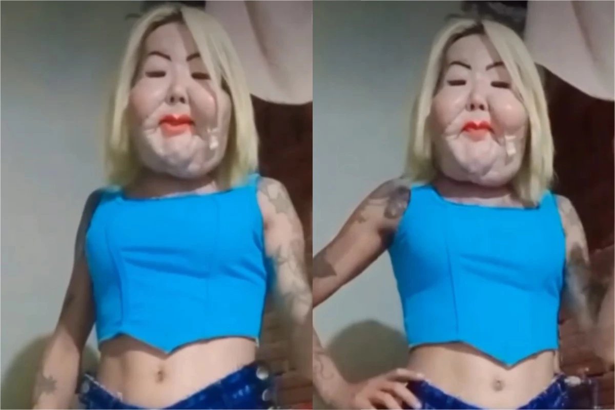 Video apos cirurgia Juju do Pix manda recado nas redes