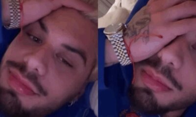 Ze Felipe revela lesao na orelha admite descuido apos sutura