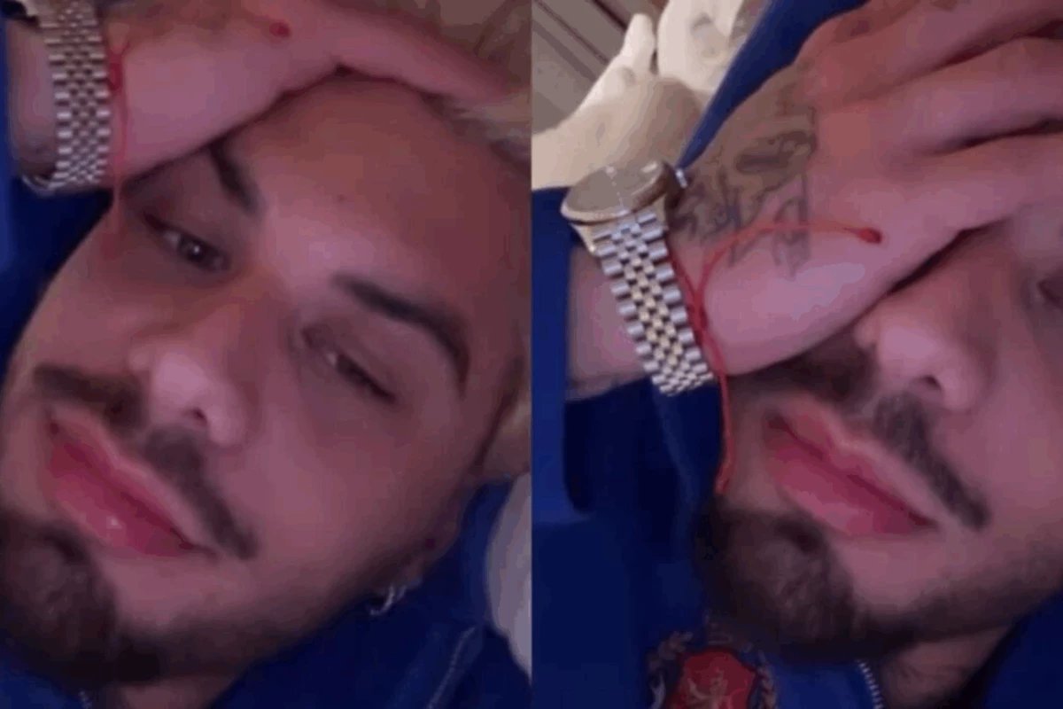 Ze Felipe revela lesao na orelha admite descuido apos sutura