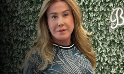 Zilu Camargo se manifesta sobre sequelas apos acidente que sofreu