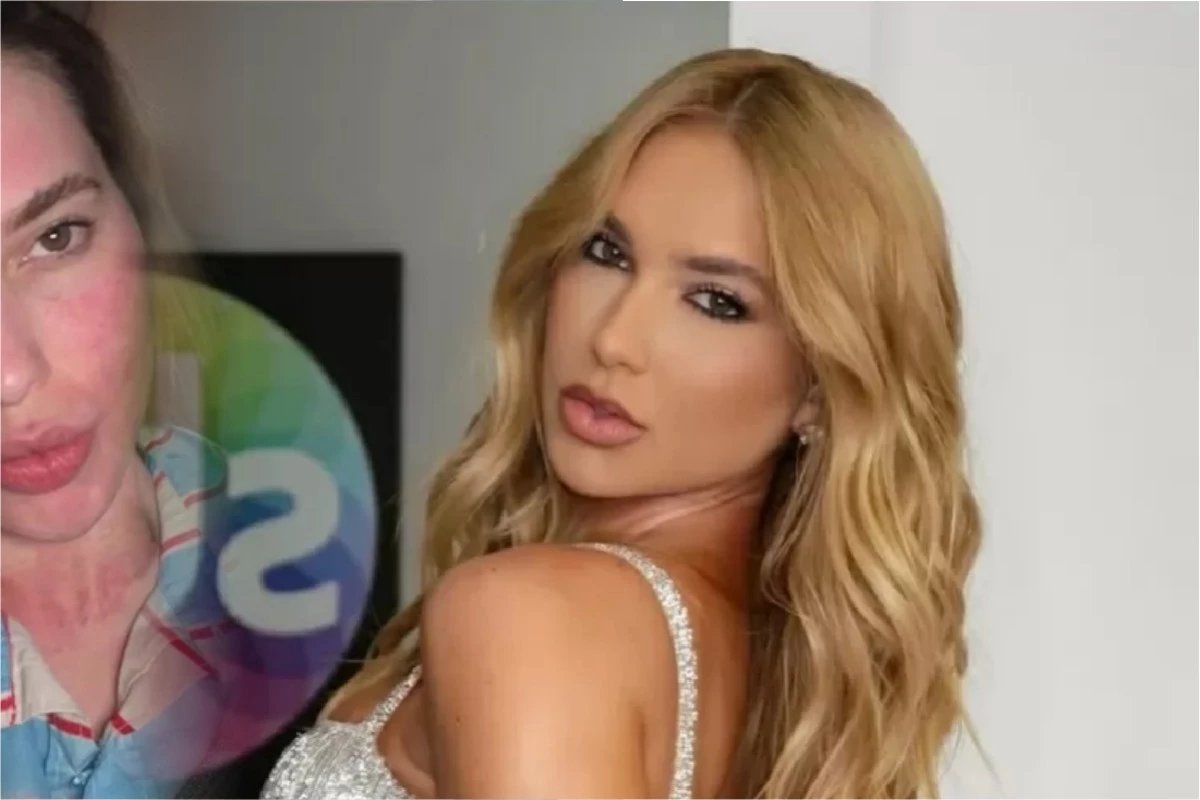 ‘Vermelha e inchada rosto de Virginia Fonseca chama a atencao