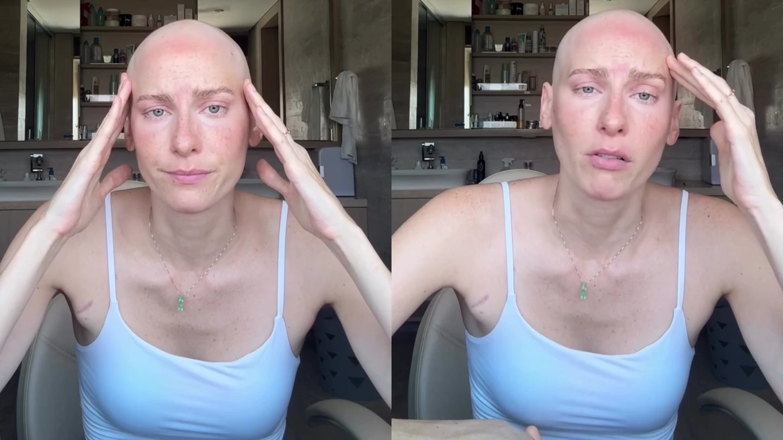 Atriz com cancer se emociona ao falar sobre autocuidado.webp
