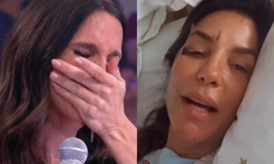 Com o olho roxo e repleta de ferimentos Ivete Sangalo