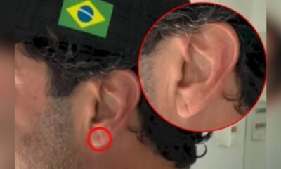 Essa dobrinha na orelha pode apontar riscos eminentes de infarto