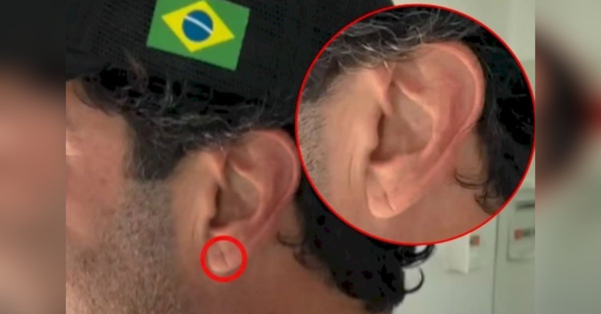 Essa dobrinha na orelha pode apontar riscos eminentes de infarto