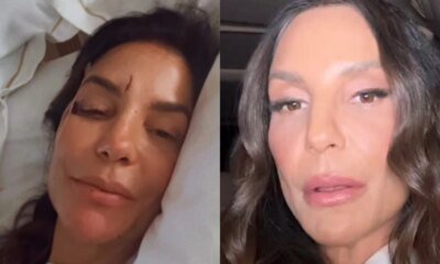 Essa e a provavel doenca que atingiu Ivete Sangalo cantora