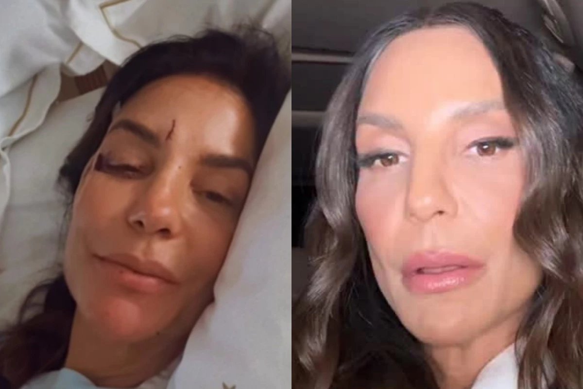 Essa e a provavel doenca que atingiu Ivete Sangalo cantora