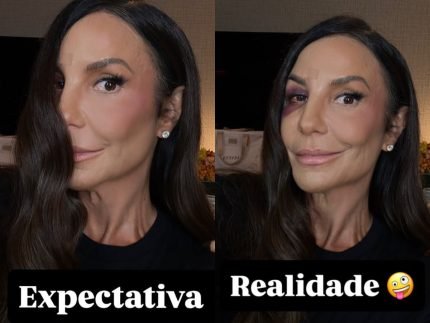 Expectativa x realidade Ivete Sangalo mostra como ficou o rosto