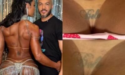 Gracyanne Barbosa inicia remocao de tatuagem intima dedicada a Belo