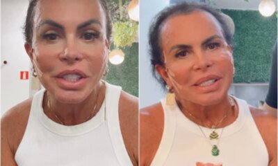 Gretchen mostra cabelo real em meio a problema de saude