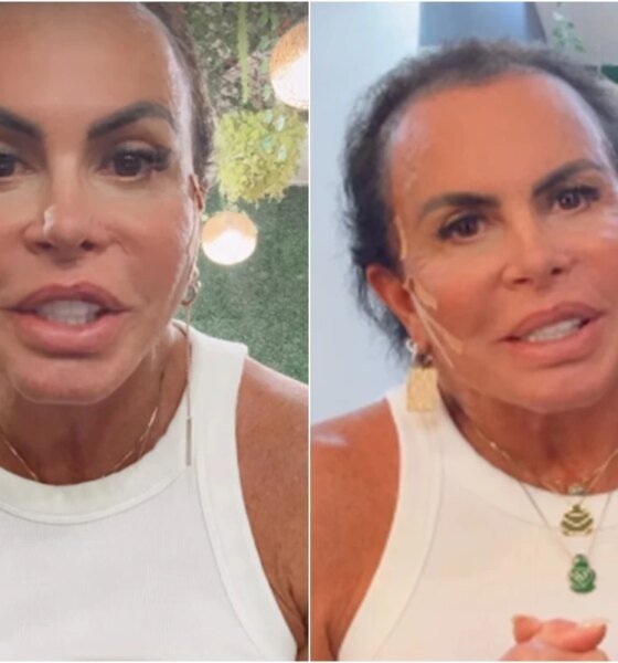 Gretchen mostra cabelo real em meio a problema de saude