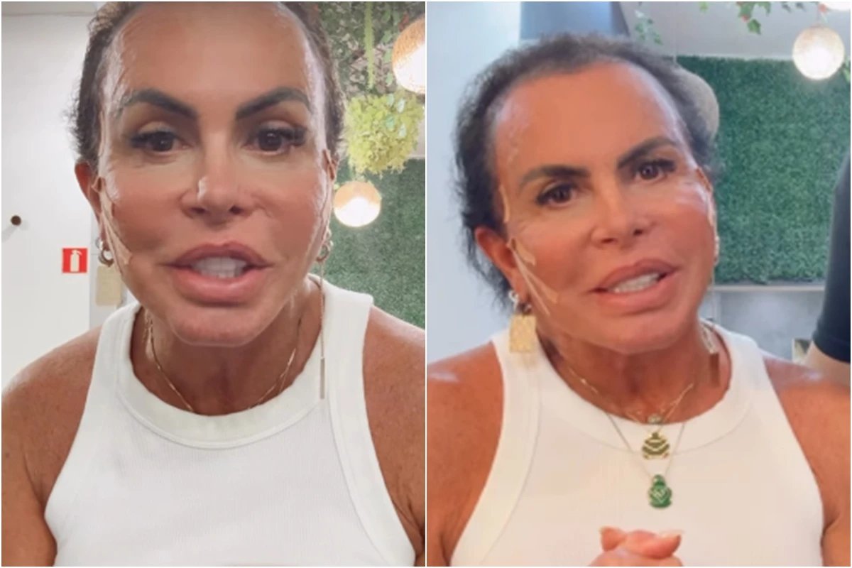 Gretchen mostra cabelo real em meio a problema de saude