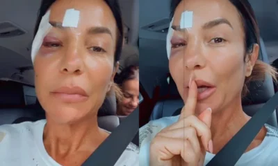 Ivete Sangalo atualiza estado de saude apos desmaio e.webp