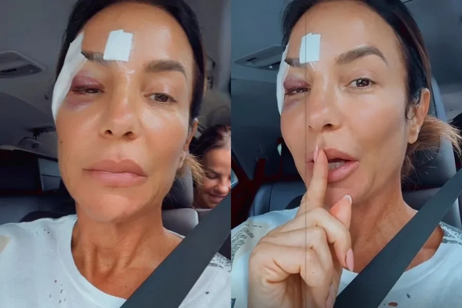 Ivete Sangalo atualiza estado de saude apos desmaio e.webp
