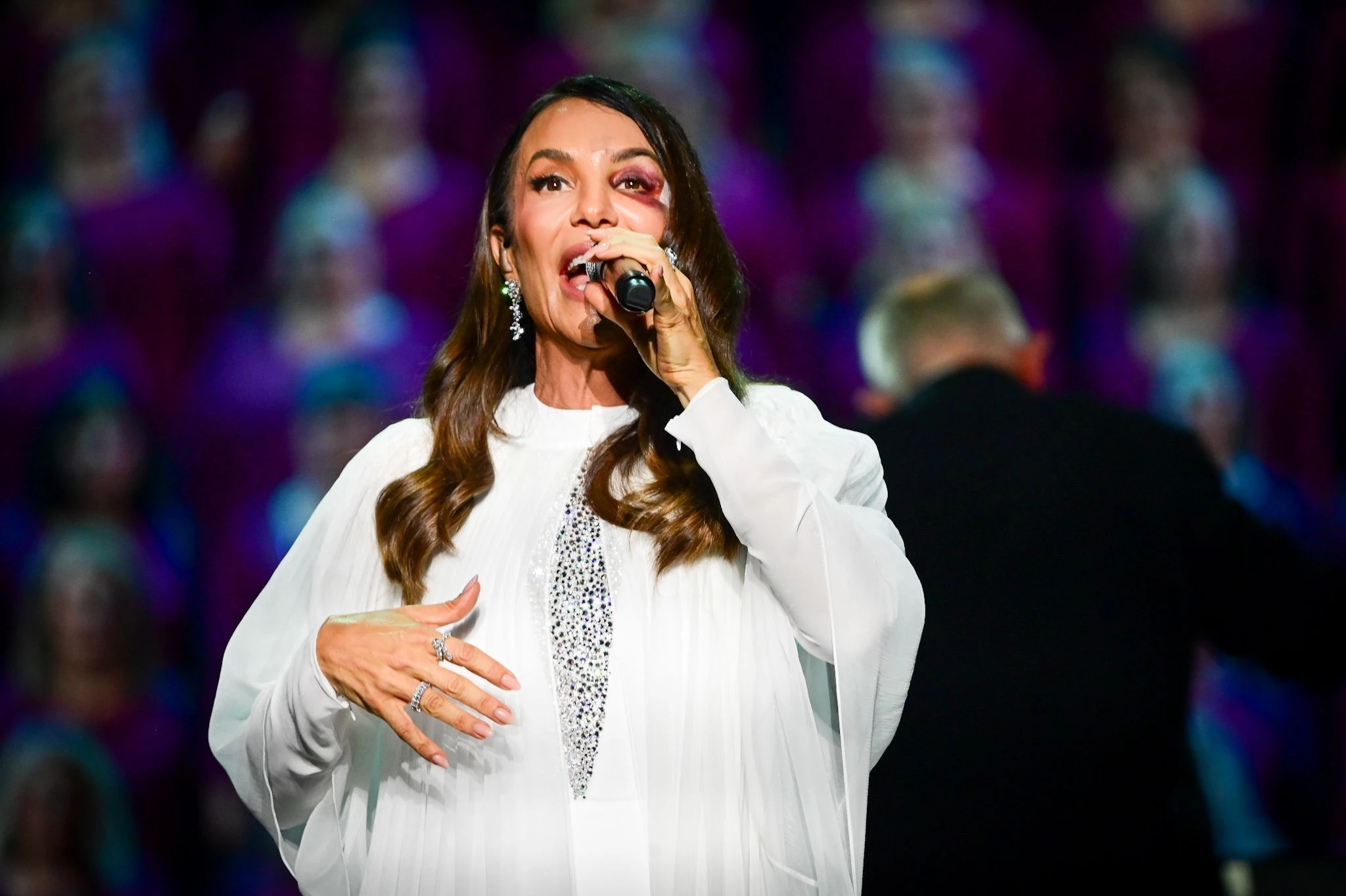 Ivete Sangalo faz primeiro show com hematoma no rosto.webp