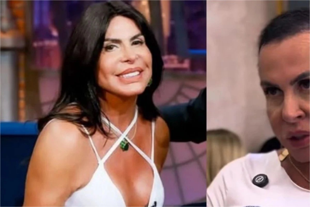 Lutando contra doenca sem cura Gretchen aparece sem protese capilar