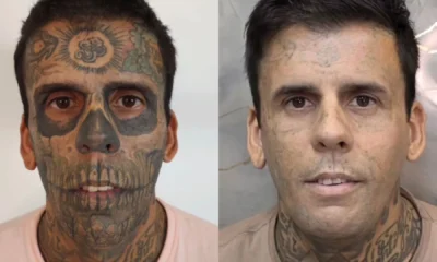 Mais tatuado do Brasil passa por nova remocao e.webp
