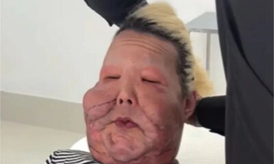 Video Juju do Pix mostra como esta seu rosto apos