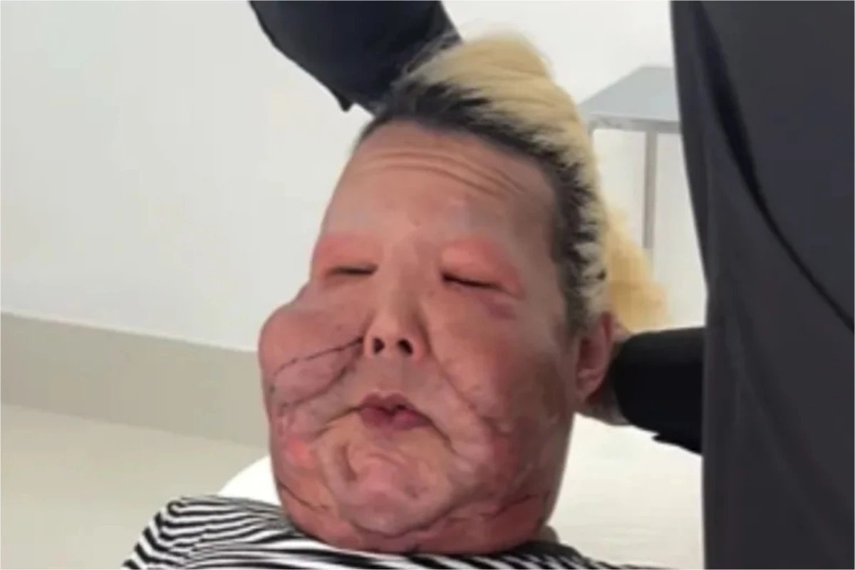 Video Juju do Pix mostra como esta seu rosto apos