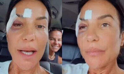 Video apos alta hospitalar Ivete Sangalo tranquiliza fas e diz