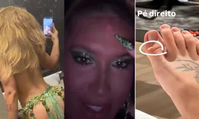 Virginia mostra machucados pelo corpo apos ensaio na Grande.webp