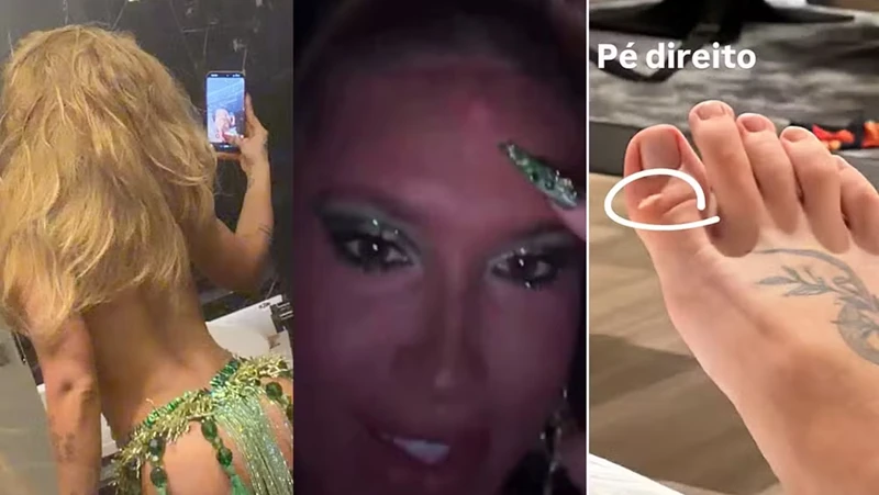 Virginia mostra machucados pelo corpo apos ensaio na Grande.webp