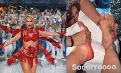 Virginia mostra os pes machucados apos ultimo ensaio na.webp