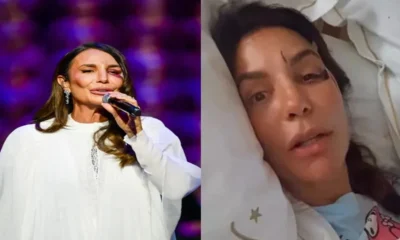 Apos acidente Ivete Sangalo rompe o silencio e revela.webp