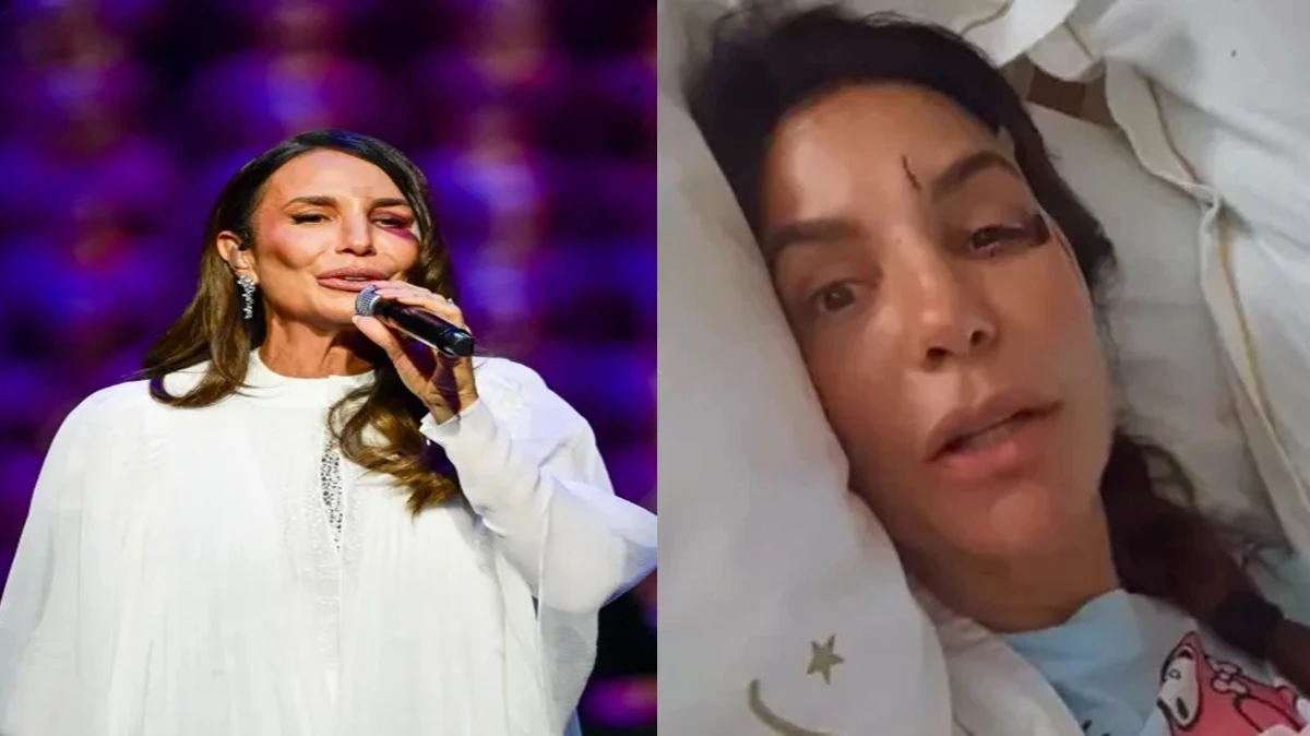 Apos acidente Ivete Sangalo rompe o silencio e revela.webp
