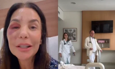 Apos cirurgia Ivete Sangalo celebra alta medica Gloria a.webp