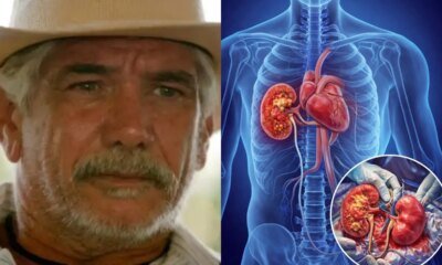 Ator Jackson Antunes e submetido a transplante detalhes sao expostos