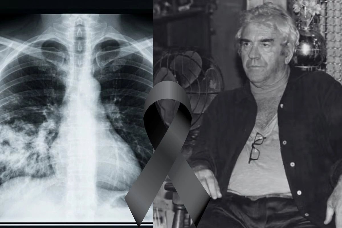 Ator Juca de Oliveira falece apos internacao e causa do