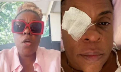 Cacau Protasio volta a enxergar apos cegueira temporaria e.webp