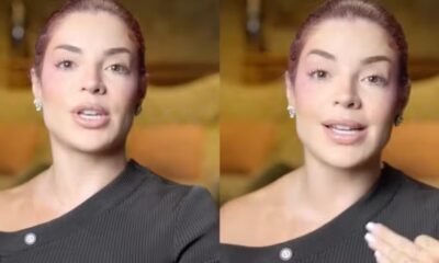 Gkay preocupa internautas ao surgir com tremedeira nas maos e