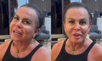 Gretchen comemora resultado de tratamento de alopecia e medica.webp