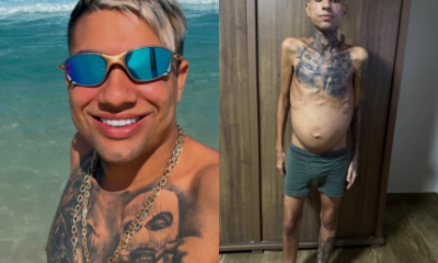 Influenciador Jota Surfista que lutava contra cancer e cirrose morre