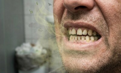 Influenciadora famosa termina o namoro apos parceiro usar caneta emagrecedora