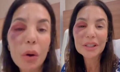 Ivete Sangalo desrespeita ordem dos medicos apos internacao ‘Fica quieta