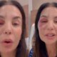 Ivete Sangalo desrespeita ordem dos medicos apos internacao ‘Fica quieta