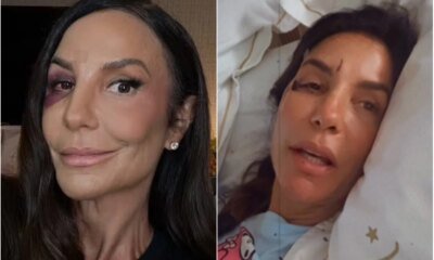 Ivete Sangalo e hospitalizada e submetida a cirurgia apos desmaio
