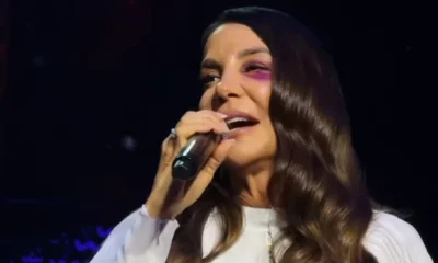 Ivete Sangalo passa por cirurgia no rosto apos queda.webp