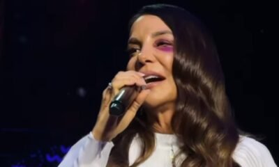 Ivete Sangalo precisou passar por cirurgia apos desmaio e queda