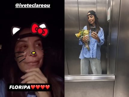 Ivete Sangalo recebe alta apos cirurgia no rosto e retorna