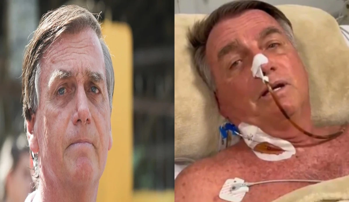 Jair Bolsonaro reclama de dor e podera passar por.webp