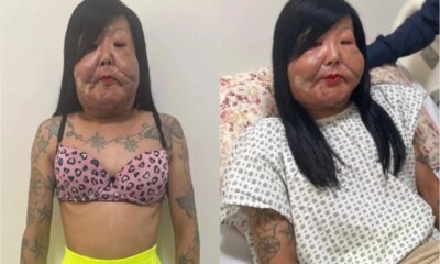 Juju do Pix e submetida a novo procedimento e medico