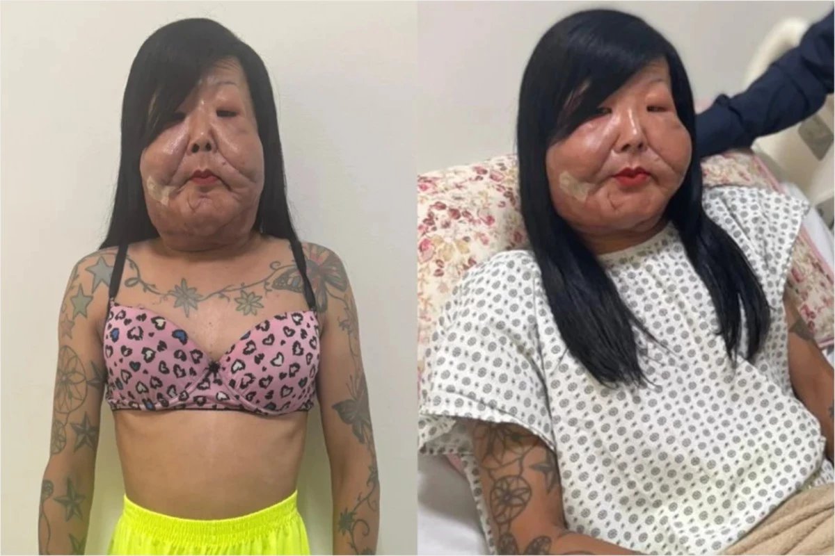 Juju do Pix e submetida a novo procedimento e medico