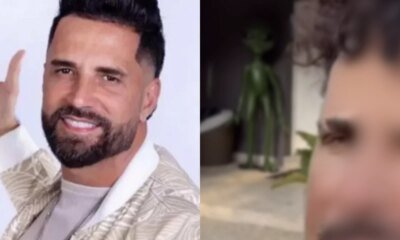 Latino passou por transformacao no rosto e quem ve o