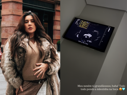 Lauana Prado mostra ultrassom do filho e atualiza evolucao de